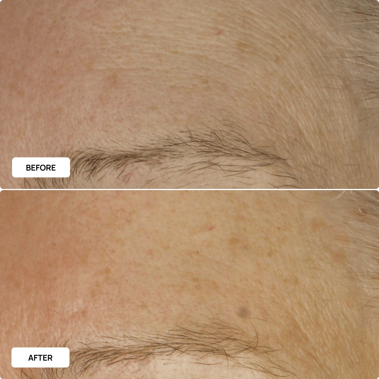 Cellular Restore Serum before and after