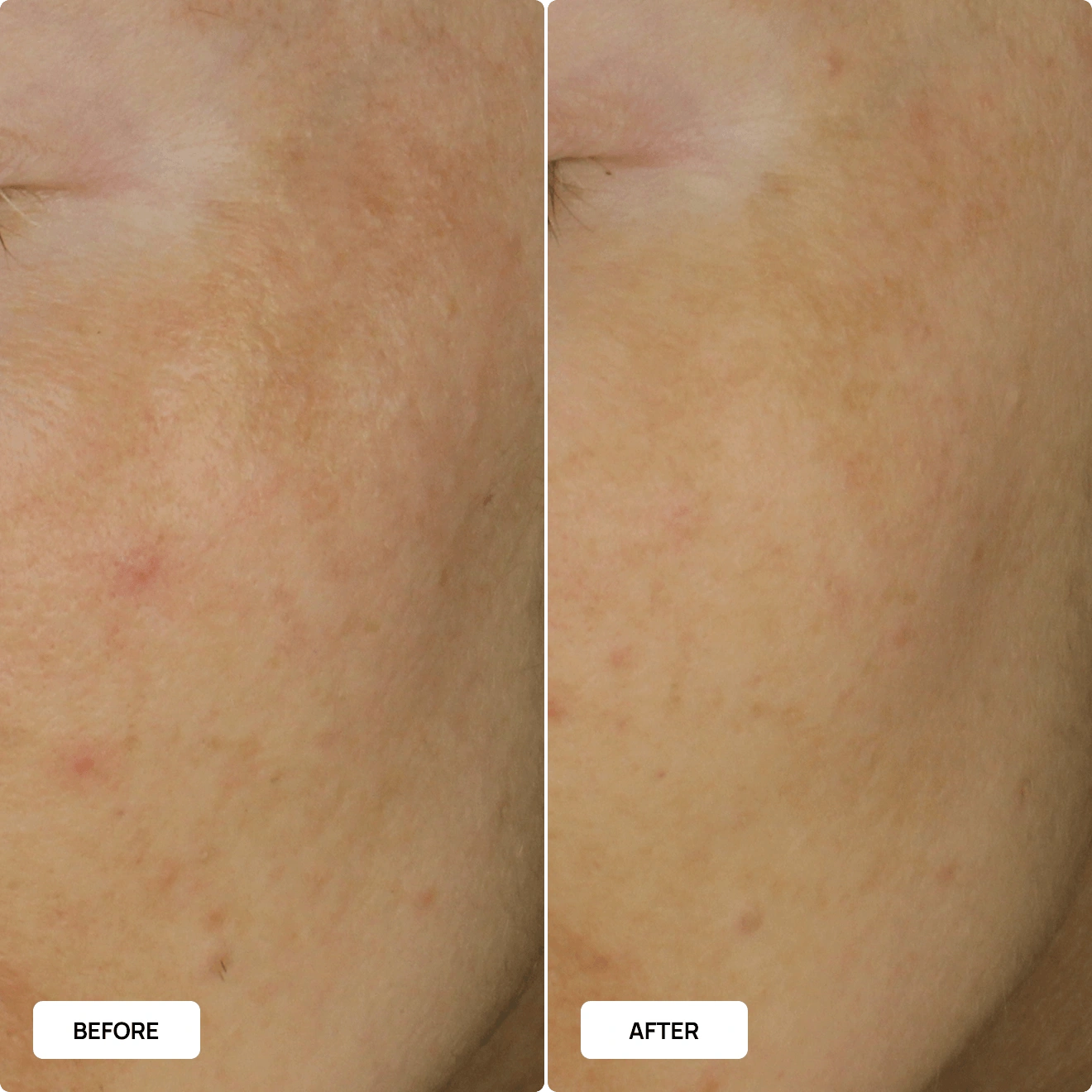 Even Glow before and after